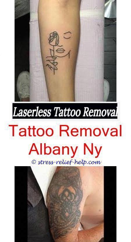Our practice also features various nonsurgical treatments, such as botox®, laser skin resurfacing, chemical peels, injectable fillers, spider vein removal, coolsculpting®, velashape® iii, and more. How long does one session of tattoo removal take.Tattoo removal new tattoo.How many laser ...