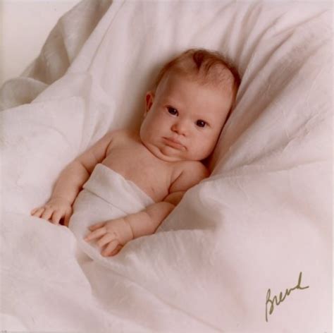 Additions or deletions of genetic material are generally lethal in utero, but trisomy 21 is an example of one form of addition in which the fetus may Photo Scanner: Down Syndrome Symptoms