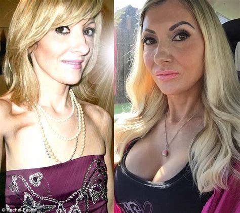 Beautifull face, gorgeous tits, nice belly, not juicy pussy, etc etc etc. Rachel Evans spends £20,000 on cosmetic surgery and ...