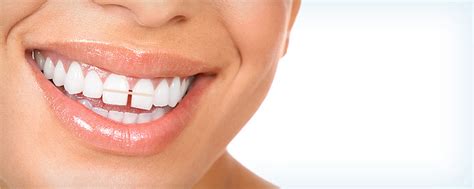 How does closing the gap with resin bonding work? Teeth Gap Bands - Close Gapped Teeth