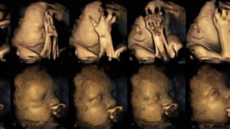 Unser team wünscht ihnen als kunde hier eine. Shocking sonogram shows how smoking affects unborn babies ...