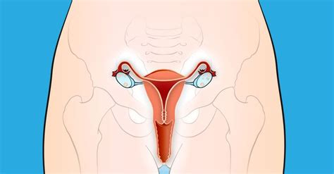 Many women are reluctant to talk about vaginal spotting, unusual discharge or physical discomfort during sex. 10 Early Warning Signs of Cervical Cancer That Women ...