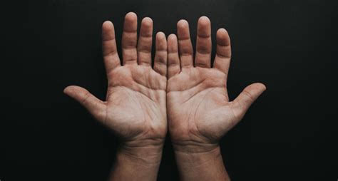 You'll find out what can increase your risk of getting this skin cancer at, basal cell carcinoma: Can I Get Skin Cancer on My Hands? | The Hand Society