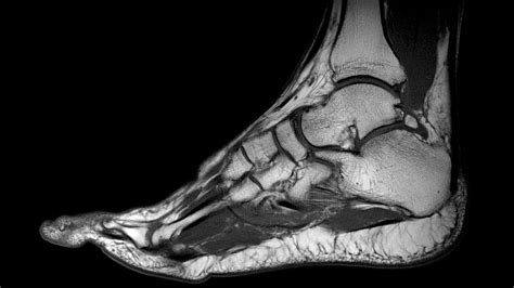 These muscles are the supraspinatus, infraspinatus, teres minor and subscapularis and that hold the head of the humerus in the glenoid cavity during movement. MRI SCAN - Fitter Feet For LifeFitter Feet For Life