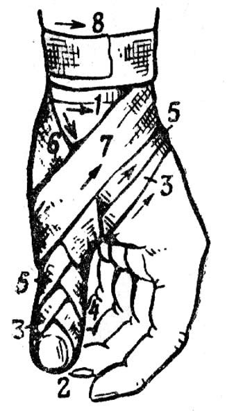 Колосовидная повязка накладывается на плечевой сустав при патологии подмышечной впадины и плеча. Спиральная повязка на палец - стр. 3