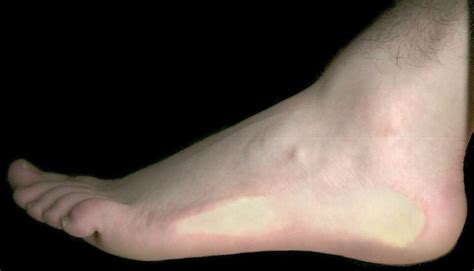 The lower extremity of the vertebrate leg that is in direct contact with. Foot - Wikipedia