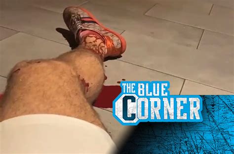 Power vs smaller technical fighter ● mike perry. Mike Perry posts graphic video of himself bleeding ...