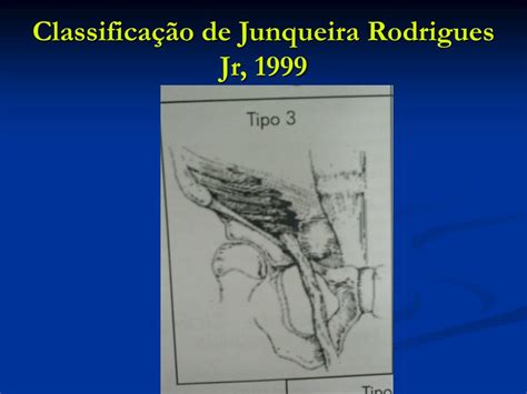 Utrolig at jeg glemte navnet på denne låte. PPT - Anatomia da Região Inguinal e Crural PowerPoint ...