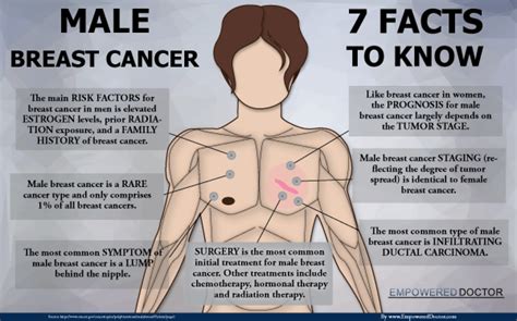 However, with enlarged male breast tissue, it now extends beyond the areola, with a minor degree of enlargement. Male Breast Cancer - 7 Facts to Know | Visual.ly