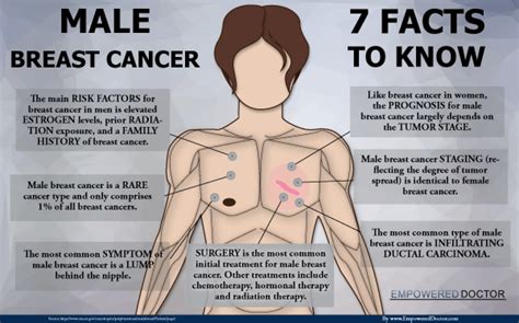 What is a female cancer like. Male Breast Cancer - 7 Facts to Know | Visual.ly