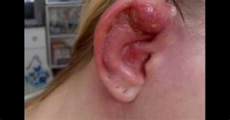 Maybe you would like to learn more about one of these? Infected Industrial Piercing