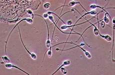 sperm sperma mikroskop microscope sperms alta minuman dilihat esperma fluido diario16 beralkohol anticonceptivos nasienia 1000x seminal necesita eficaz farmacéuticas masculinos