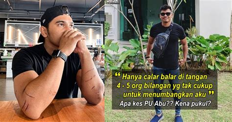 To do this, just paste the link to the post you like in the search field and click the. "Tak cukup untuk tumbangkan aku" - Calar Balar, PU Abu ...