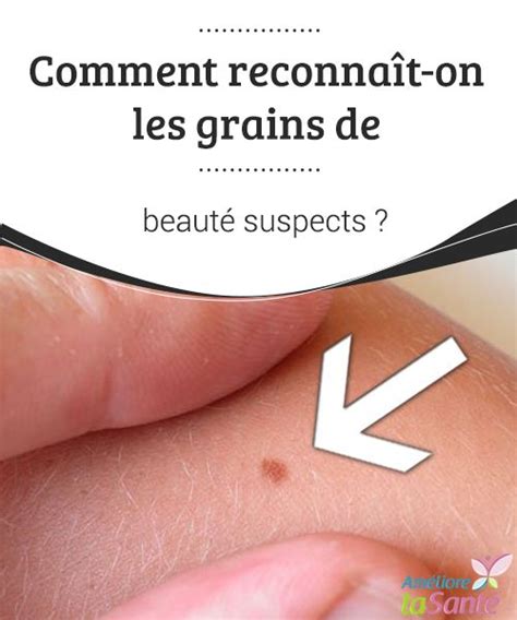 Les grains de beauté sont généralement assez petits, on peut commencer à s'inquiéter quand leur diamètre dépasse les 6 mm. Comment reconnaît-on les grains de beauté suspects ...