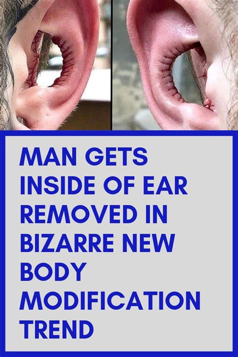 Assessment | biopsychology | comparative | cognitive | developmental | language | individual differences | personality | philosophy | social | methods | statistics | clinical | educational | industrial | professional items | world psychology |. Man Gets Inside of Ear Removed in Bizarre New Body ...