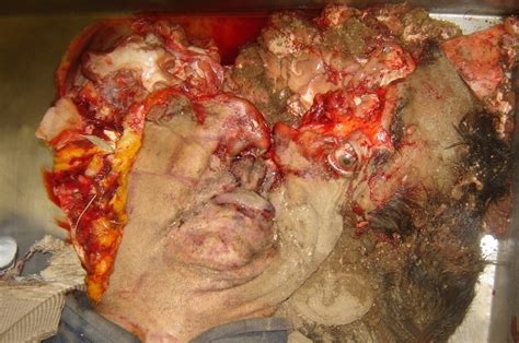 Man's head crushed by trailer | Fear Hideous Trauma Weird