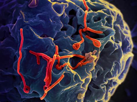 Se desconoce si estas personas pueden resultar infectadas con una especie diferente del virus del ébola. MARBURG ALIAS EBOLA : UN VIRUS MUTANT ALEATOIRE