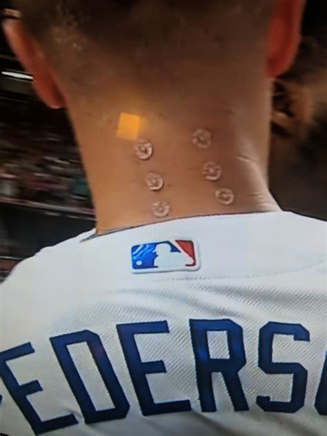 This allows more space for the spinal cord. What are these on the back of Joc Pederson's neck? : sports