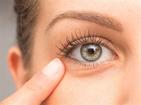 Berikut 13 pengobatan rumahan untuk atasi mata hitam. Penyebab dan Cara Mengatasi Berbagai Tipe Lingkaran Hitam ...