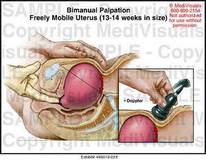 Don't be surprised if weight gain starts to speed up at 14 weeks pregnant. Bimanual Palpation (13-14 weeks) Medical Illustration ...