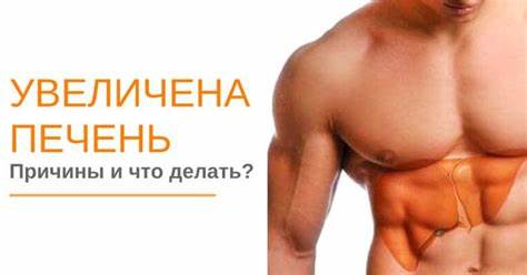 Увеличена печень и селезенка диета Увеличена печень: причина увеличения, что это значит, что делать, какие Увеличена печень: причина увеличения, что это значит, что делать, какие Увеличена печень и селезенка диета