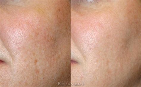 We did not find results for: Uneven Skin Texture - NaturalSkins