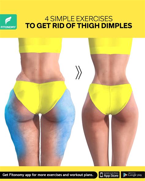 And the cost for this procedure may reach up to 6000$. GET RID OF THIGH DIMPLES - detox tea - Global Blog