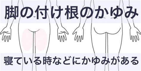 足のアトピー治療（症例2） | 川崎市多摩区のアトピー専門整体 ...