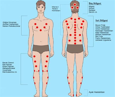 Fibromiyaljide sıklıkla tetik noktalar veya hassas noktalar olarak adlandırılan vücut alanları bulunur. Hacamat Noktaları | Geleneksel çin tıbbı, 30 günlük ...