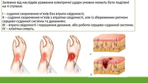 Можна зробити висновок, що повний опір тіла людини визначається опором шкіри, що мас великий опір, та. Дія електричного струму на організм людини