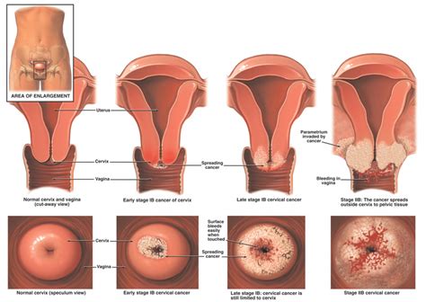 Of course, cancers do not routinely go away, and no one is suggesting that patients avoid treatment because of such occasional occurrences. Symptoms