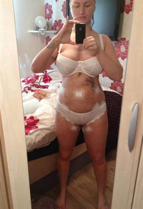 Get more videos like these here ! Plastic surgery addict spends £25k on dream body | Daily Star