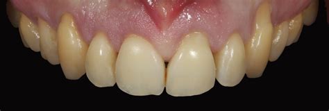 We would like to show you a description here but the site won't allow us. Caso 1 - Periodontologia • Clínica Marisa Zenha - Clinica ...
