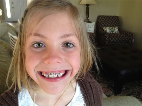 Posted by girls with braces lover at 1:05 pm 3 comments. The Jackson Family: Braces!!