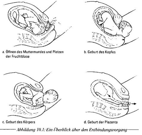 Der zervixkanal ist in der schwangerschaft durch den inneren und äußeren muttermund verschlossen. Die vaginale Entbindung während der Geburt ...