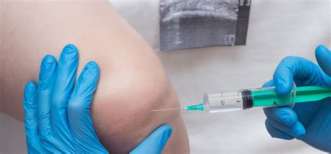 All veterinarians can perform flash and fast ultrasounds. Ultrasound Joint Injections - American Urgent Care