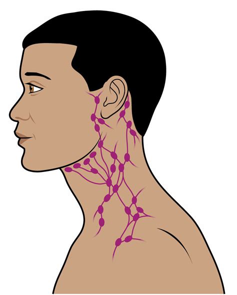 Lymph nodes have clinical significance. The lymphatic system - Macmillan Cancer Support