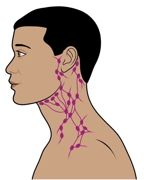 Even a canker sore in the mouth can cause lymph nodes to swell. The lymphatic system - Macmillan Cancer Support