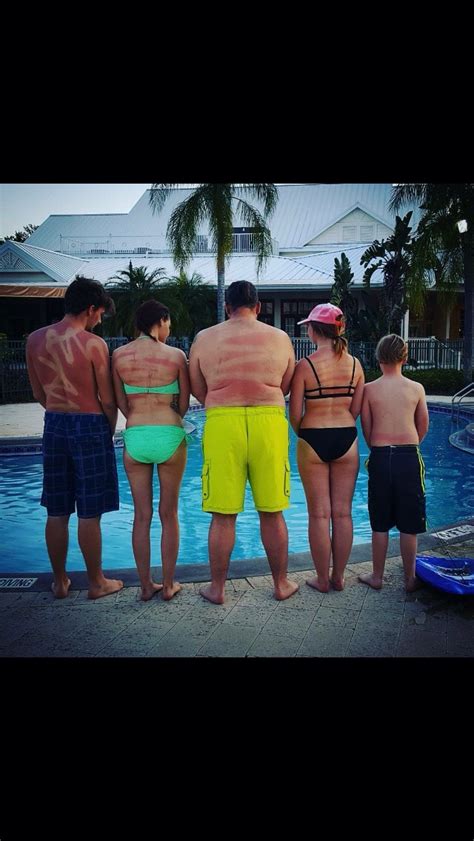 This Is What Happens If You Don't Use Spray On Sunscreen ...