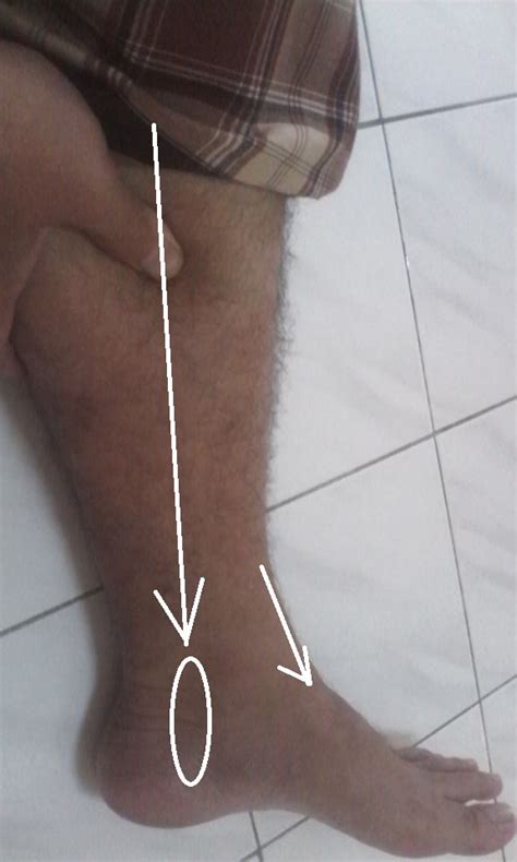 Paha agak di depan, lutut dan pergelangan kaki agak ke belakang terhadap garis khayal dari pusat gravitasi perpendikuler dari lantai. Kaedah URUT KAKI TERSELIUH (PERGELANGAN KAKI.)