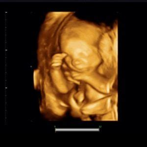 Wenn sich dein baby bereits vollständig in die geburtsposition. ᐅ 23. SSW (Schwangerschaftswoche): Alle Infos, Größe ...