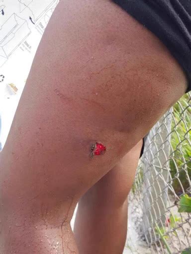 Domestic cats can fall from any height with a remarkable survival rate. Fees must fall - how rubber bullets can harm students