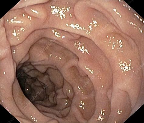 Segmentation mixes the chyme with enzymes from the small intestine and. Healthy duodenum, small intestine - Stock Image - C001 ...