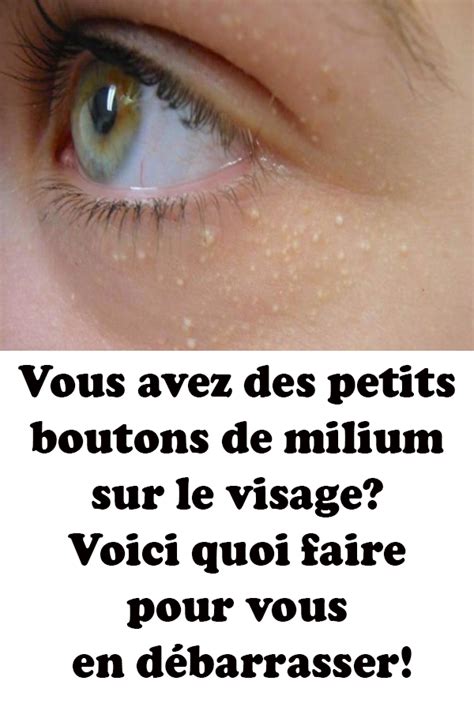 Le visage est une zone sensible, dont il faut prendre soin au quotidien. Vous avez des petits boutons de milium sur le visage ...