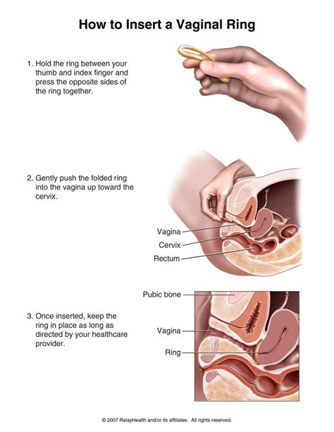 If you have a high risk of blood clots, you may need to wait longer. Dr. Pacha Dharma