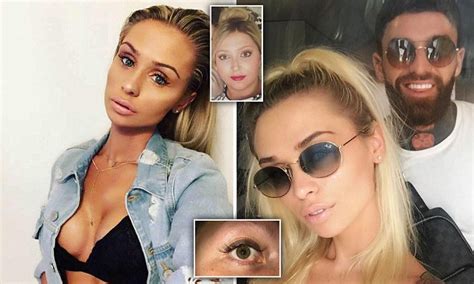 Maybe you would like to learn more about one of these? Girlfriend of Geordie Shore's Aaron Chalmers gave 'botched ...