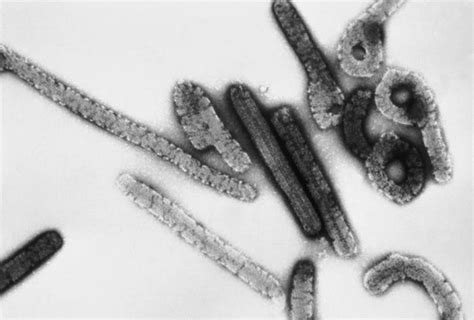 Marburg marburgvirus is the only filovirus, to date, that has actually been african ebolaviruses and marburg marburgvirus are typically lethal in experimentally infected nonhuman primates. El ébola y sus compañeros más mortales; los 10 peores ...