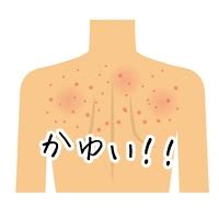 背中がかゆい!こんな症状 | 背中が乾燥してかゆい!