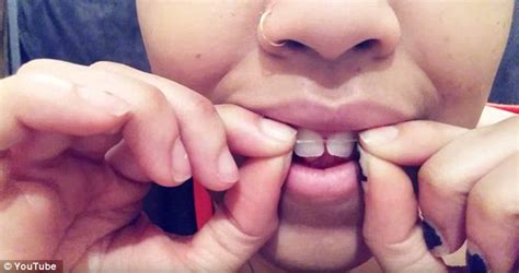 We buy, test, and write reviews. DIY BRACES made with elastic bands will ruin gums and make teeth fall out | Daily Mail Online