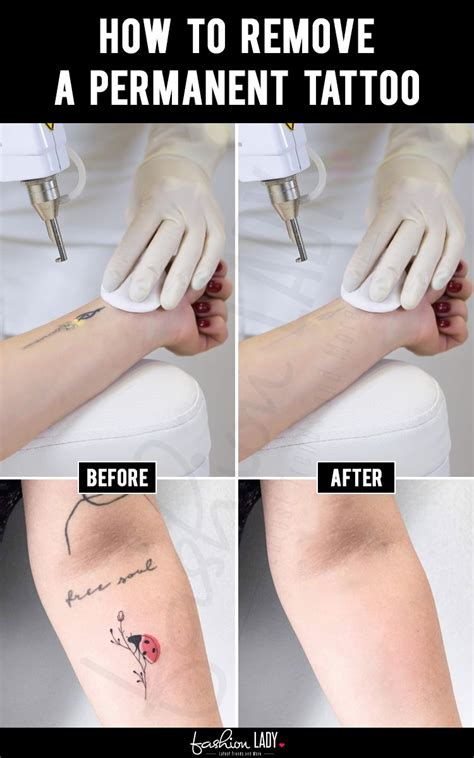 Salt scrub helps exfoliate the skin, which helps to remove tattoo pigmentation. How To Remove A Permanent Tattoo (With images) | Permanent ...